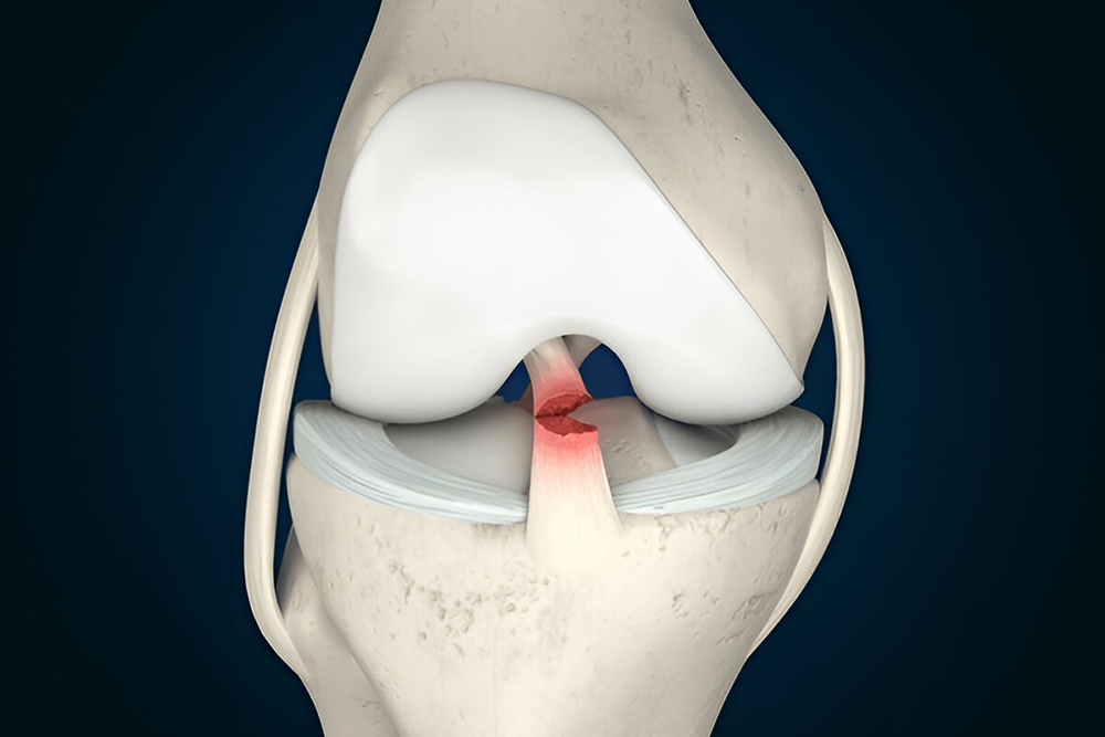 Knee Pain – Emphatic